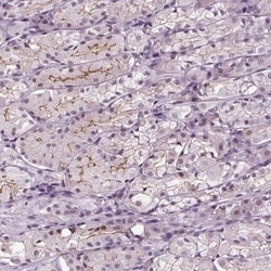 SLC9A4 Antibody, Novus Biologicals 25 &mu;L, Unlabeled:Antibodies, Polyclonal